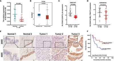 SLC25A21 Suppresses Cell Growth in Bladder Cancer via an Oxidative Stress-Mediated Mechanism